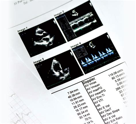 Scan Your Heart - This Quarterly