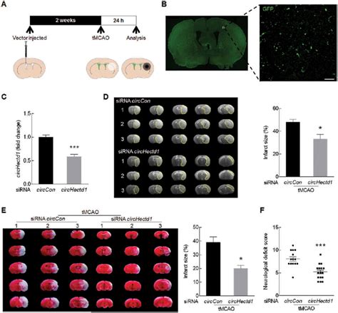 Knockdown Of Circhectd Expression Reduces Brain Infarction In Tmcao