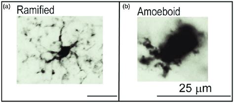 The Different Morphological Phenotypes Of Microglia Using Iba1 Panel