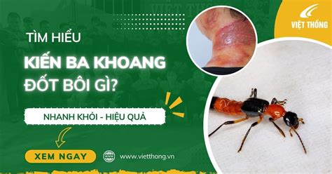 cach tri kien ba khoang  tai nha hieu qua nhat