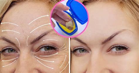 Cómo usar la vaselina para eliminar las arrugas del contorno de ojos 3