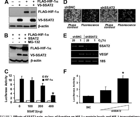 Figure 2 From Spermidine Spermine N1 Acetyltransferase 2 Is An