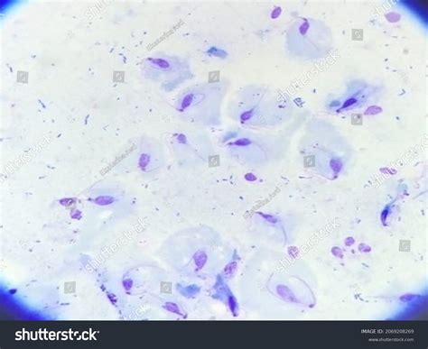 Trichomonas Vaginalis Anaerobic Flagellated Protozoan Parasite库存照片2069208269 Shutterstock