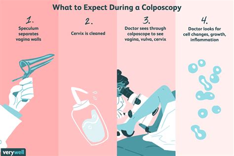 Abnormal Pap Smear Colposcopy