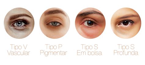 Dra Bruna Biagini Dermatologista Itaim Bibi São Paulo