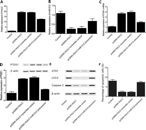 Regulatory Relationships Among HULC MiR 512 PTGS1 And PGE1 In THP 1