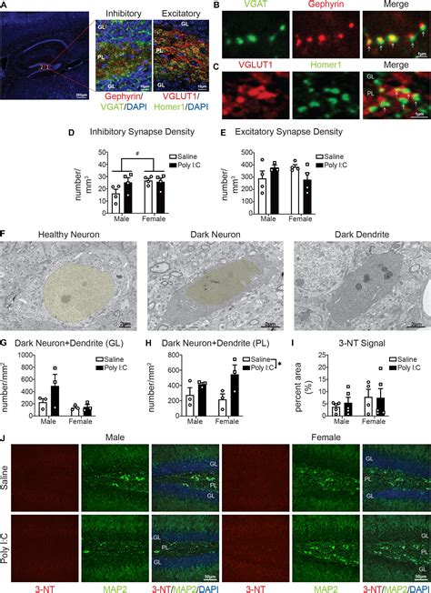 Frontiers Sex Differences Of Microglia And Synapses In The