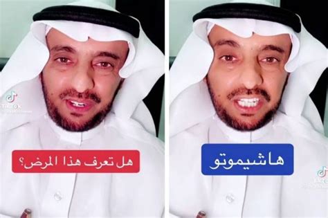 شاهد استشاري يكشف عن أعراض مرض هاشيموتو الذي يصيب النساء أكثر من