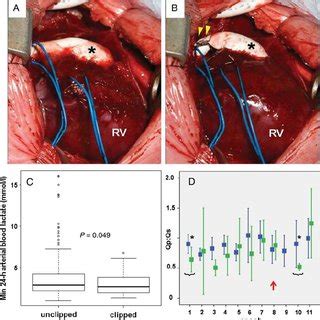 PDF Temporary Restriction Of Right Ventricle Pulmonary Artery Conduit