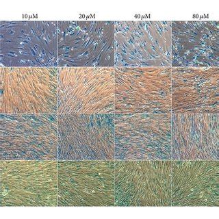 (a) Conventional qualitative SA-β-gal assay by X-gal staining of bone ...