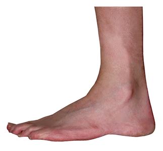 Two Ankles On Each Foot Hotsell Emergencydentistry