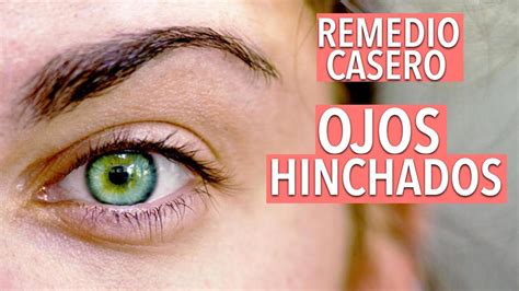 Como Quitar Los Ojos Hinchados Ojeras Y Bolsas En Los Ojos Yasmany