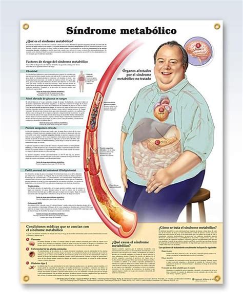 Sindrome Metabolico 20x26 Anatomy Poster Nursing Tips, Nursing Study ...