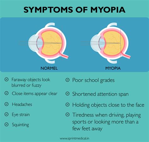 Symptoms of myopia : r/myopia