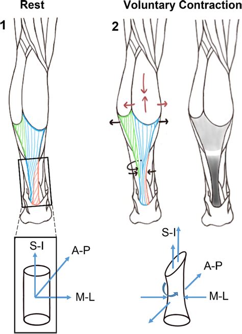 Strain Patterns Of The Achilles Tendon During A Voluntary Contraction