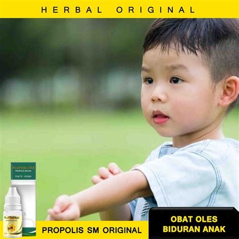 Jual OBAT OLES BIDURAN ANAK - OBAT BIDURAN UNTUK ANAK - OBAT USIR BIDURAN - KALIGATA BENTOL ...