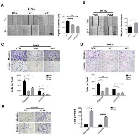 High Plk Expression Promotes Tumor Progression And Induces Epithelial