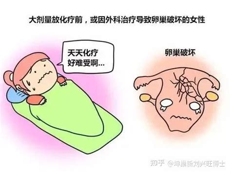 卵巢功能不全常见的病因有哪些？ 知乎