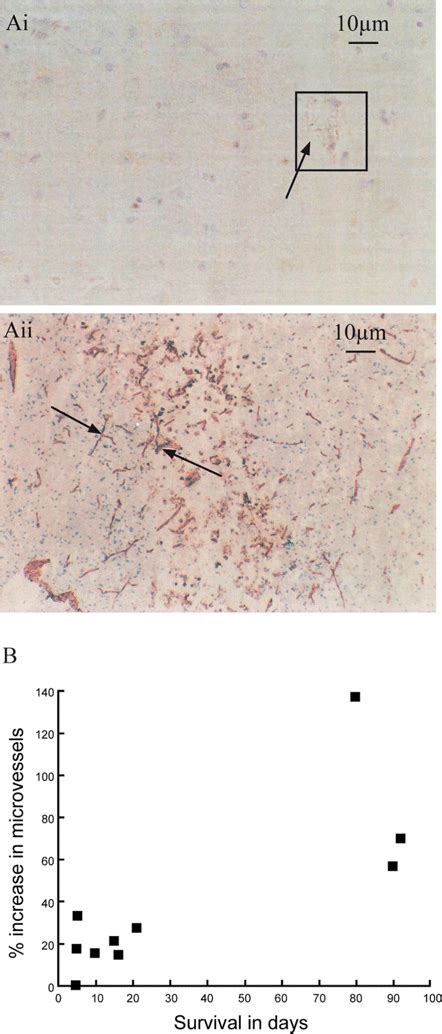 Increased Microvessel Density Seen In The Periinfarcted Tissue Of A