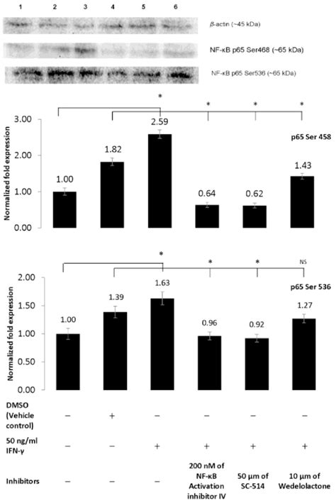 A β Actin And Phosphorylated Nf κb P65 Protein Bands On Blotted Pvdf