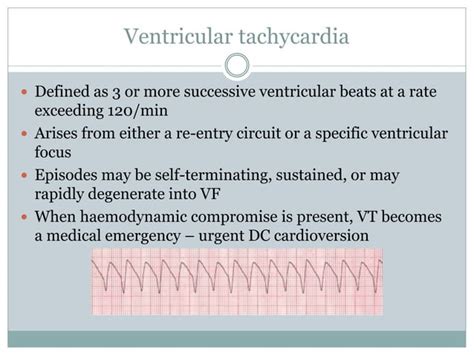 Interpretation of common ecg abnormalities | PPT