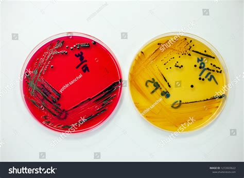 Bacteria Culture Media Stock Photo 1272603622 | Shutterstock