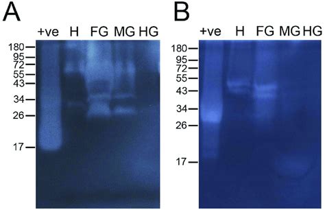 Detection Of Cellulase Activity In Digestive Fluids Of Thermobia