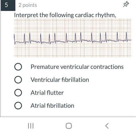 Solved Points Aa Interpret The Following Cardiac Rhythm Chegg