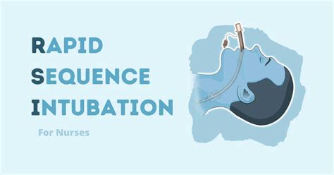 RSI Intubation for Nurses: Rapid Sequence Intubation | Health And Willness