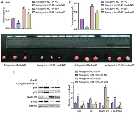 MiR181bp53 Negative Feedback Axis Regulates Osteosarcoma Cell