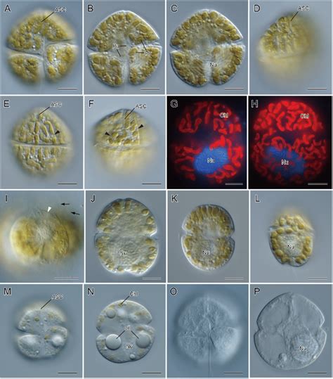 Morphological Variations Of Karenia Selliformis Found In The Hokkaido