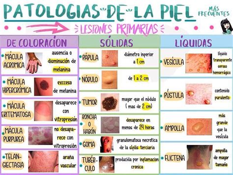 Lesiones Cut Neas La Escuelita M Dica Oposiciones Auxiliar De