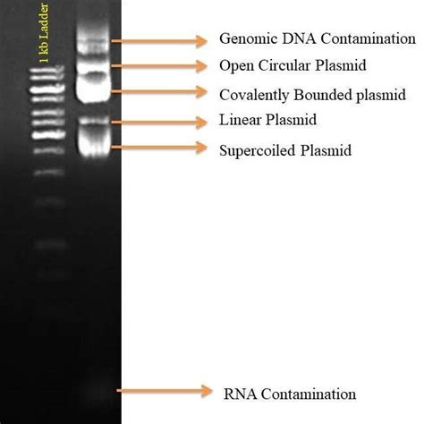 Plasmid DNA Gel Electrophoresis