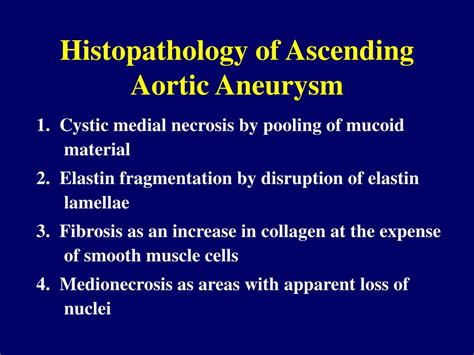 Ppt Diseases Of The Aorta Powerpoint Presentation Free Download Id 4218452