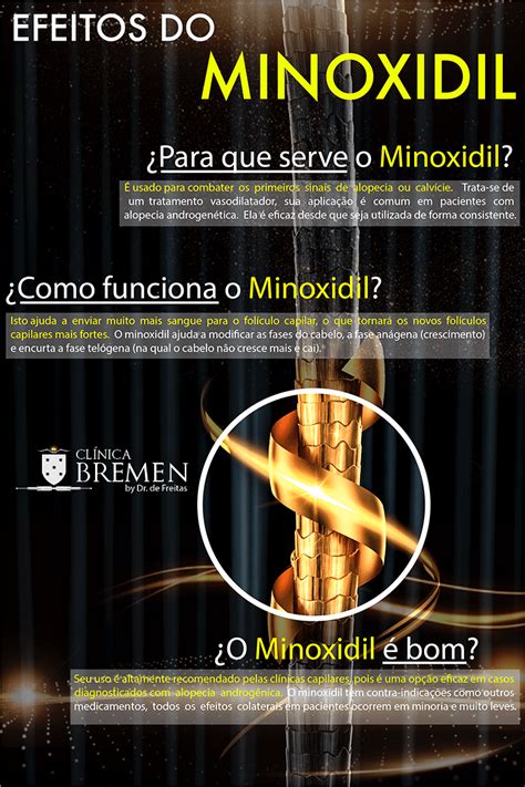 O Que Minoxidil E Para Que Serve Cl Nica Bremen