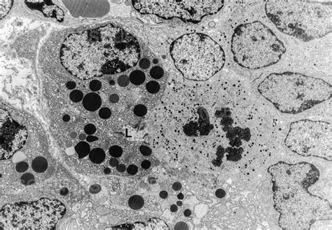 Islet Cell Mitosis Tem Stock Image Science Source Images