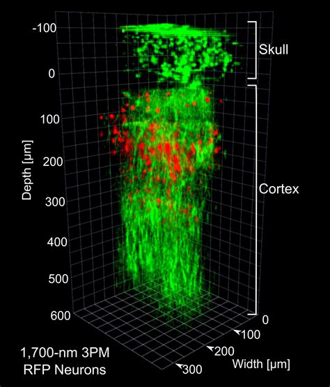 Multiphoton Microscopy: Deeper, Wider, and Faster