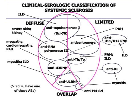 Updated systemic sclerosis criteria improve disease classification ...