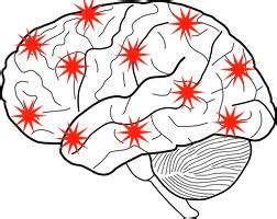 Generalised Seizures - The Epilepsy Rollercoaster