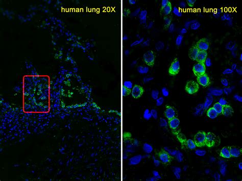 Rabbit Anti Sftpc Polyclonal Antibody N Term Absin