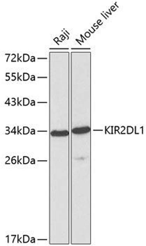 Anti Kir2dl1 抗体 Cab1697 Assay Genie