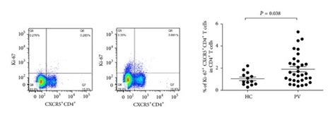 Increased Frequency Of Circulating Cxcr Cd Tfh Ctfh Cells In