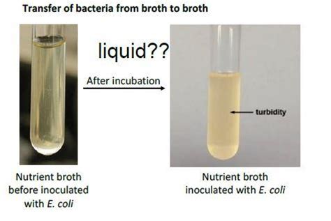 Solved Transfer of bacteria from broth to broth liquid?? | Chegg.com