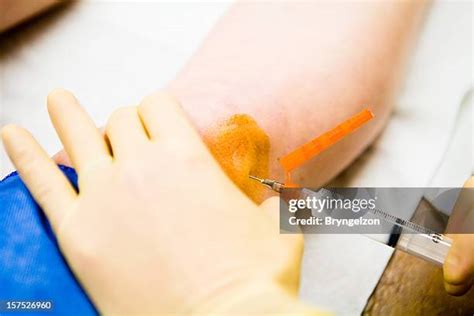 98 Knee Injection Stock Photos, High-Res Pictures, and Images - Getty ...