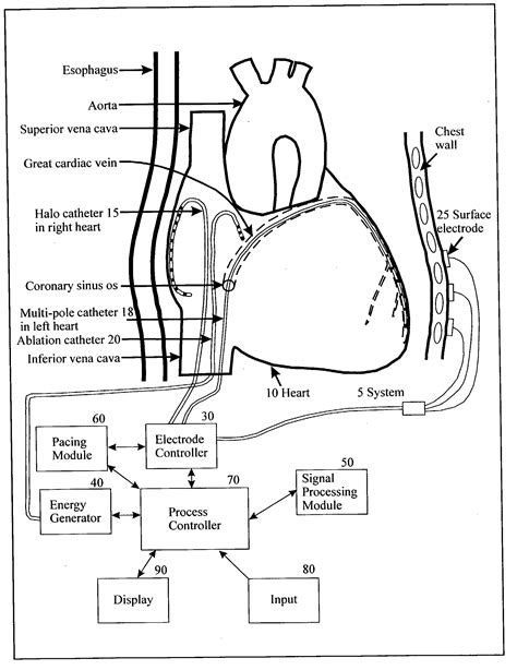 Surface electrocardiogram patented technology retrieval search results