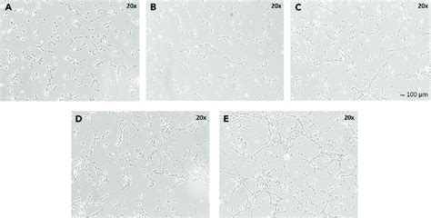 Development of neurons isolated from chick embryo brain (A-E) Cultured ... 