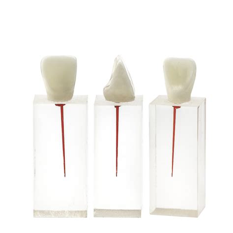 Эндоблок Revyline "Дентальный канал" TM-406 Резец, купить в интернет ...