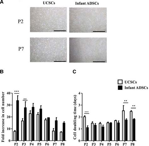 Multilineage Differentiation Potential In The Infant Adipose