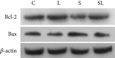 Observation of cell apoptosis in hippocampus. (a) HE staining; (b ... 