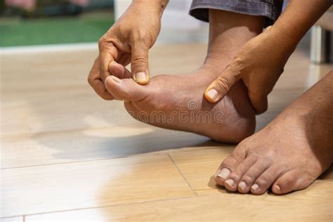 Senior Man Massage Foot With Painful Swollen Gout Inflammation Stock